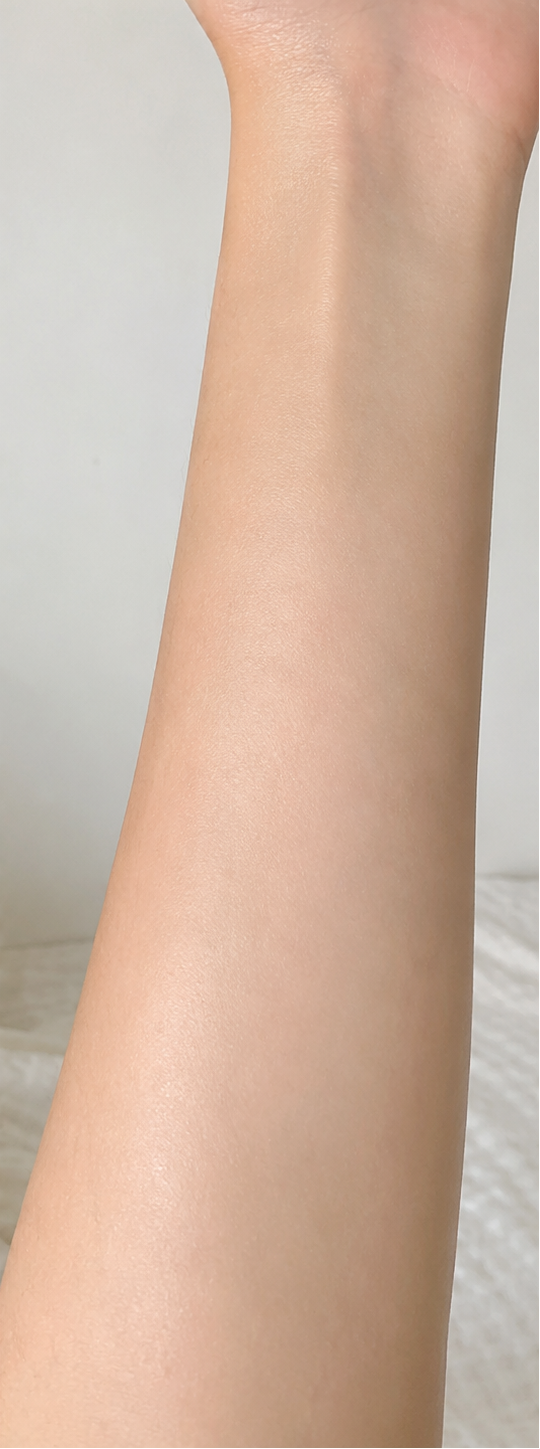 Arms after